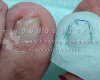 Ejemplo