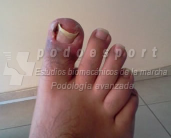 Ejemplo