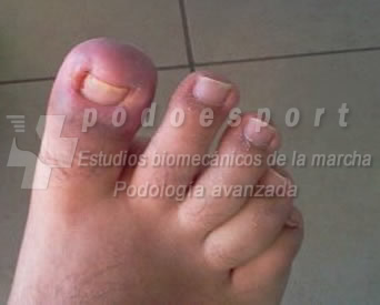 Ejemplo