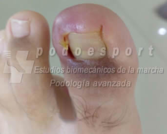 Ejemplo