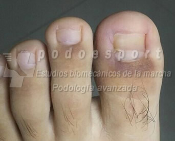 Ejemplo